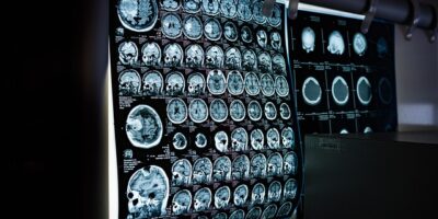 嘉大成立醫學院籌備處暨中醫藥產業創新發展中心揭牌！盼產官學合作提升嘉義醫療量能